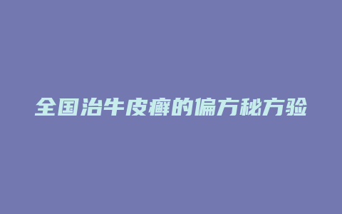 全国治牛皮癣的偏方秘方验方